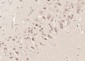 SRP68 Polyclonal Antibody